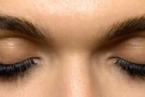 Bellevue Kosmetik Institut &ndash; Dauerhafte Haarentfernung