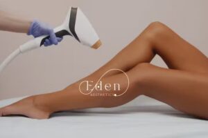 Eden Aesthetics &ndash; Laser Haarentfernung Bonn