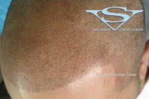 GI-MHP/SV Susanna Vierk&ouml;tter Fachpraxis f&uuml;r Haarpigmentierung