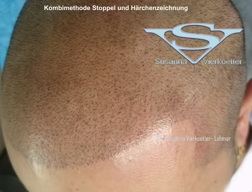 GI-MHP/SV Susanna Vierk&ouml;tter Fachpraxis f&uuml;r Haarpigmentierung