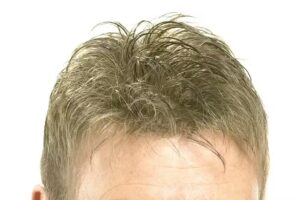 Haarpraxis Blankenhagen