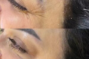 Kosmetik und Lasern Ghazala