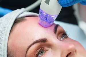 Kosmetikstudio &Auml;sthetic Rf Lifting Z&auml;hne Bleaching Zahnaufhellung in N&auml;he Pirmasens