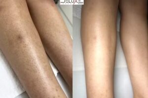 Laser Deluxe Rastatt