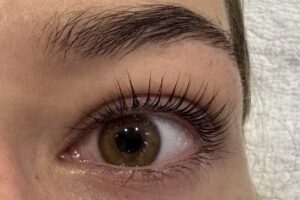 MB Medical Beauty Treatments -Olching