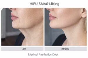 Medical Aesthetics Dost