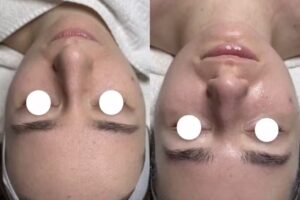 MOO&Eacute; AESTHETICS