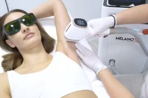 NAZAR Skin | Dortmund