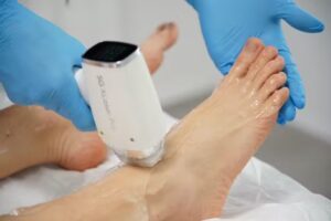 SG Laserzentrum Mainz- Dauerhafte Haarentfernung