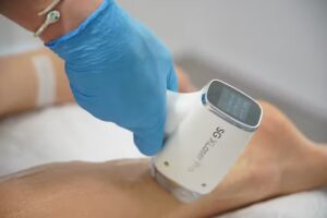 SG Laserzentrum Stuttgart-Dauerhafte Haarentfernung Stuttgart