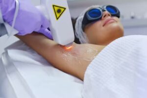 Soft Skin Braunschweig | Laserstudio | Aquafacial | Kryolipolyse | Microneedling